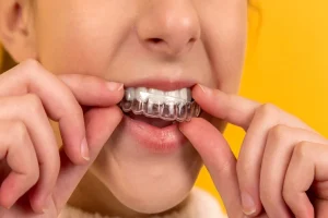 What are the Best Braces Options for Adults?
