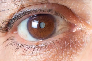 Cataract Symptoms: Early Signs of Motiyabind You Should Never Ignore