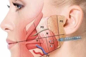 Can Botox Help With TMJ Jaw Pain And Clenching?