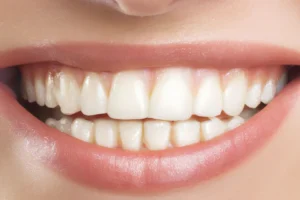 5 Best Dental Implant Providers 2026 – Where To Go To Enhance Your Smile